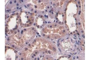 Detection of F1+2 in Human Kidney Tissue using Monoclonal Antibody to Prothrombin Fragment 1+2 (F1+2) (Prothrombin Fragment 1+2 抗体)