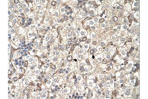 Immunohistochemistry (IHC) image for anti-ST3 beta-Galactoside alpha-2,3-Sialyltransferase 4 (ST3GAL4) (Middle Region) antibody (ABIN2782704) (ST3GAL4 抗体  (Middle Region))