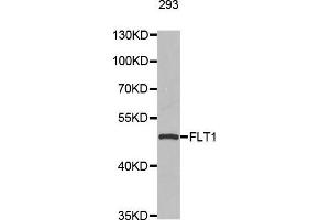 Western blot analysis of extracts of 293 cell line, using FLT1 antibody.