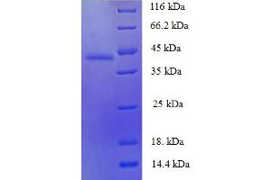 SDS-PAGE (SDS) image for Betacellulin (BTC) (AA 32-178) protein (GST tag) (ABIN5709151)