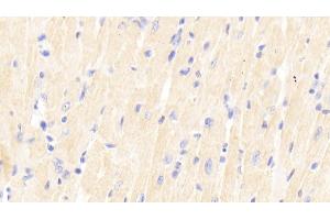 Detection of SIRT2 in Mouse Cardiac Muscle Tissue using Polyclonal Antibody to Sirtuin 2 (SIRT2) (SIRT2 抗体  (AA 65-340))