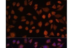 Immunofluorescence analysis of L929 cells using ARMC6 Polyclonal Antibody at dilution of 1:100. (ARMC6 抗体)