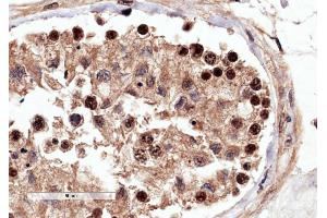 Immunohistochemistry (IHC) image for anti-Rac GTPase Activating Protein 1 (RACGAP1) (C-Term) antibody (ABIN184690)