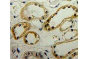 Used in DAB staining on fromalin fixed paraffin-embedded Kidney tissue (LIMS1 抗体  (AA 68-303))