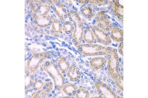 Immunohistochemistry of paraffin-embedded rat kidney using ALDH1A2 antibody. (ALDH1A2 抗体  (AA 1-180))