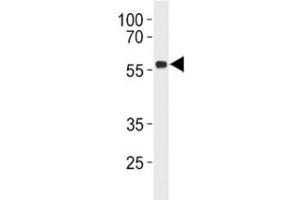 Western Blotting (WB) image for anti-Tumor Protein P53 (TP53) (AA 293-322) antibody (ABIN3029384)