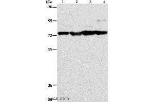 Western blot analysis of Mouse stomach, heart and liver tissue, HT-29 cell, using MMP15 Polyclonal Antibody at dilution of 1:200 (MMP15 抗体)