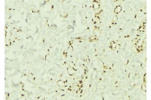 Immunohistochemistry (IHC) image for anti-Protein tyrosine Phosphatase, Non-Receptor Type 11 (PTPN11) (C-Term) antibody (ABIN6265075)