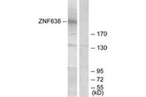 Western blot analysis of extracts from HepG2 cells, treated with serum 20% 15', using ZNF638 Antibody.