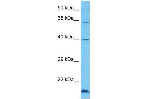 Host:  Rabbit  Target Name:  GRHL3  Sample Tissue:  Human 786-0 Whole Cell  Antibody Dilution:  1ug/ml (GRHL3 抗体  (C-Term))
