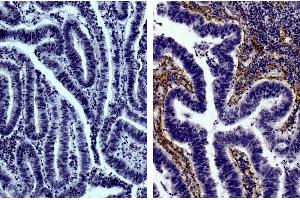 Immunohistochemistry (IHC) image for anti-Collagen, Type IV (COL4) antibody (Biotin) (ABIN135053)