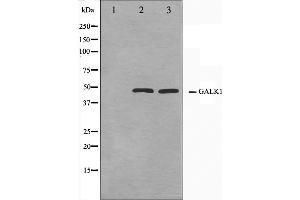 Western blot analysis on NIH-3T3 and HeLa cell lysate using GALK1 Antibody,The lane on the left is treated with the antigen-specific peptide. (GALK1 抗体  (C-Term))