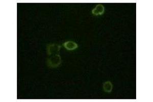 Immunofluorescence staining of methanol-fixed Hela cells using ABL2 mouse mAb showing cytoplasm localization. (ABL2 抗体)