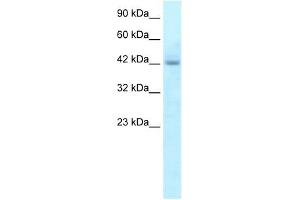 RGS20 antibody used at 5 ug/ml to detect target protein. (RGS20 抗体  (N-Term))