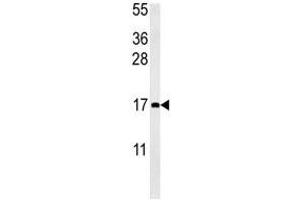 CCL4 antibody western blot analysis in mouse bladder tissue lysate (15ug/lane). (CCL4 抗体  (AA 22-48))