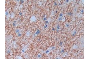 Immunohistochemistry (IHC) image for anti-Protease, serine, 2 (Trypsin 2) (PRSS2) (AA 24-241) antibody (ABIN7433747)