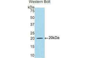 Detection of Recombinant LTF, Human using Polyclonal Antibody to Lactoferrin (LTF) (Lactoferrin 抗体  (AA 542-685))