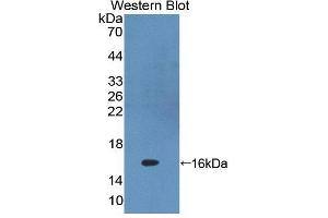 Western blot analysis of the recombinant protein. (PKIG 抗体  (AA 1-76))
