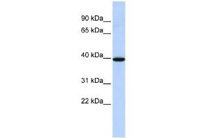 NMBR antibody used at 1 ug/ml to detect target protein. (NMBR 抗体  (N-Term))