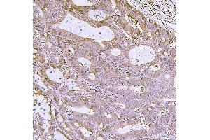 IHC analysis of IRF3 using anti-IRF3 antibody (ABIN7599385).