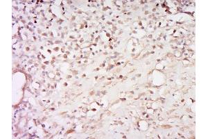 Immunohistochemistry (Paraffin-embedded Sections) (IHC (p)) image for anti-Nuclear Receptor Subfamily 3, Group C, Member 1 (Glucocorticoid Receptor) (NR3C1) (pSer226) antibody (ABIN1713964)