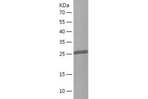 Western Blotting (WB) image for Cardiac Troponin I (TNNI3) (AA 2-211) protein (His tag) (ABIN7283966) (TNNI3 Protein (AA 2-211) (His tag))