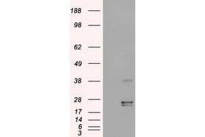 Western Blotting (WB) image for anti-Oncostatin M (OSM) (AA 25-252) antibody (ABIN1491278)