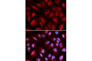 Immunofluorescence analysis of U2OS cells using MCM5 antibody (ABIN5973237). (MCM5 抗体)