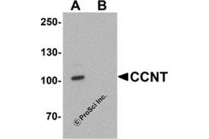 Western Blotting (WB) image for anti-Cyclin T1 (CCNT1) (C-Term) antibody (ABIN1077437) (Cyclin T1 抗体  (C-Term))