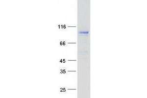 Western Blotting (WB) image for N-Deacetylase/N-Sulfotransferase (Heparan Glucosaminyl) 3 (NDST3) protein (Myc-DYKDDDDK Tag) (ABIN2726992)