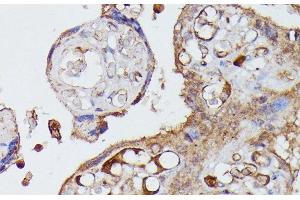 Immunohistochemistry of paraffin-embedded Human placenta using AGT Polyclonal Antibody at dilution of 1:100 (40x lens). (AGT 抗体)