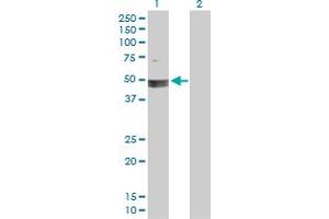 Western Blot analysis of SMARCB1 expression in transfected 293T cell line by SMARCB1 MaxPab polyclonal antibody. (SMARCB1 抗体  (AA 1-385))