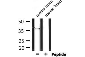 Western blot analysis of extracts from mouse brain, using OR4D5 Antibody. (OR4D5 抗体)