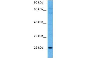 Host:  Rabbit  Target Name:  KRTAP27-1  Sample Tissue:  Human RPMI 8226 Whole Cell lysates  Antibody Dilution:  1ug/ml (KRTAP27-1 抗体  (N-Term))
