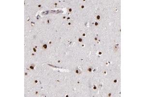 Immunohistochemical staining of human cerebral cortex with NUP62CL polyclonal antibody  shows strong nuclear positivity in neuronal cells at 1:200-1:500 dilution. (NUP62CL 抗体)