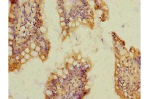 Immunohistochemistry of paraffin-embedded human small intestine tissue using ABIN7170776 at dilution of 1:100