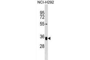 Western Blotting (WB) image for anti-N-Acetylglucosamine-1-Phosphate Transferase, gamma Subunit (GNPTG) antibody (ABIN3000049) (GNPTG 抗体)