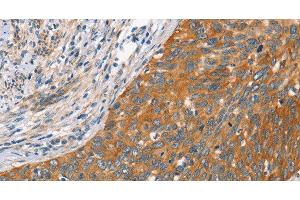 Immunohistochemistry (Paraffin-embedded Sections) (IHC (p)) image for anti-Heat Shock 22kDa Protein 8 (HSPB8) antibody (ABIN7235168)