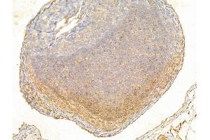 ABIN6261598 and ABIN6266535 at 1/100 staining Rat kidney tissue by IHC-P.