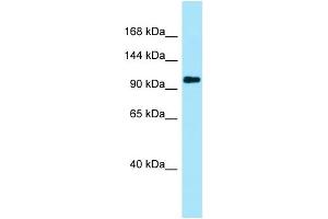 WB Suggested Anti-PKP4 Antibody Titration: 1.