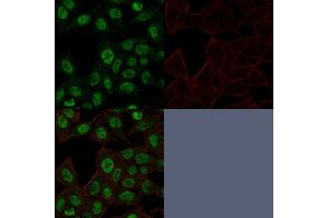 Confocal Immunofluorescence image of HeLa cells using Topo II alpha, Monoclonal Antibody (TOP2A/1361). (Topoisomerase II alpha 抗体  (AA 1352-1493))