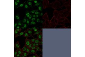 Confocal Immunofluorescence image of HeLa cells using Topo II alpha, Monoclonal Antibody (TOP2A/1361).