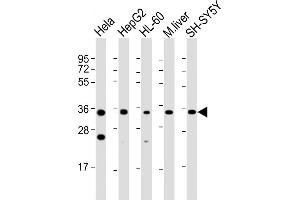 All lanes : Anti-ADORA3 Antibody (C-Term) at 1:2000 dilution Lane 1: Hela whole cell lysate Lane 2: HepG2 whole cell lysate Lane 3: HL-60 whole cell lysate Lane 4: mouse liver lysate Lane 5: SH-SY5Y whole cell lysate Lysates/proteins at 20 μg per lane.