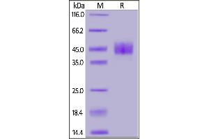 Mouse Mesothelin (298-600), His Tag on  under reducing (R) condition. (Mesothelin Protein (MSLN) (AA 298-600) (His tag))
