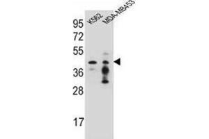 Western Blotting (WB) image for anti-Phosphate Cytidylyltransferase 1, Choline, alpha (PCYT1A) antibody (ABIN2996564) (PCYT1A 抗体)