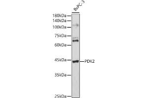 Western blot analysis of extracts of BxPC-3 cells, using PDK2 antibody (ABIN1681304, ABIN3018413, ABIN3018414 and ABIN6220461) at 1:3000 dilution. (PDK2 抗体  (AA 128-407))