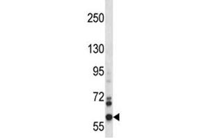 NOX5 antibody western blot analysis in CEM lysate. (NOX5 抗体  (AA 680-709))