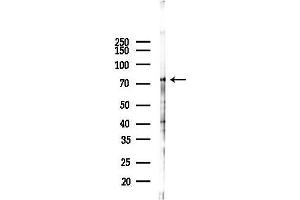 anti-Myxovirus Resistance Protein 1 (MX1) (C-Term) antibody