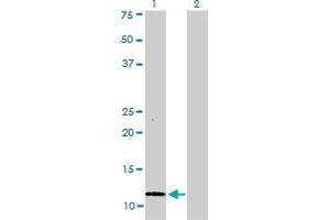Western Blot analysis of S100A1 expression in transfected 293T cell line by S100A1 monoclonal antibody (M01), clone 1D5. (S100A1 抗体  (AA 1-75))