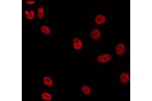 ABIN6274890 staining HepG2 by IF/ICC. (DDX51 抗体  (C-Term))